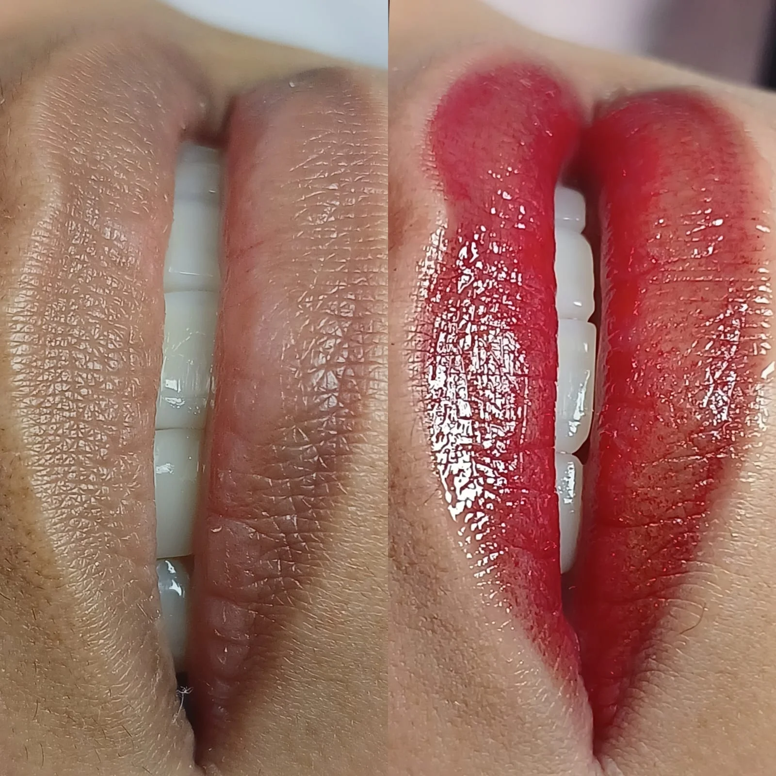 Antes e depois de micropigmentação labial realizada pela equipe Kamila Leal